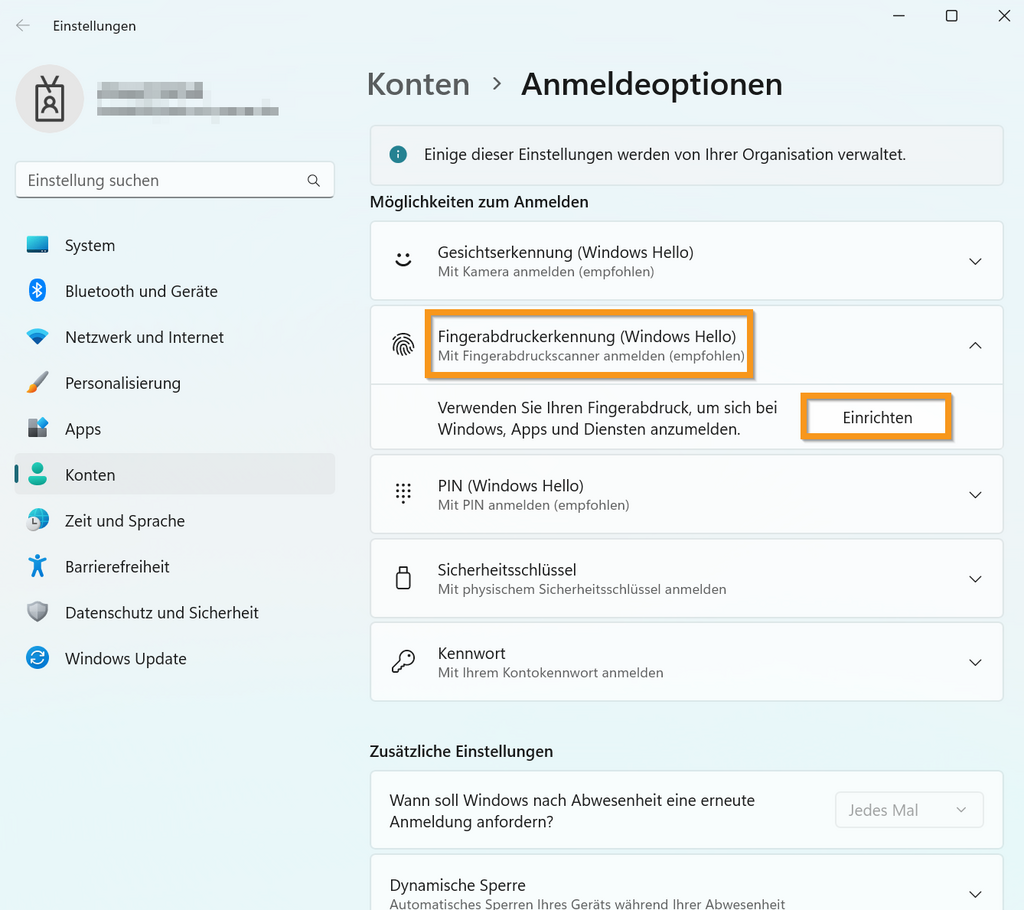 [Translate to Englisch:] Schritt_1.png